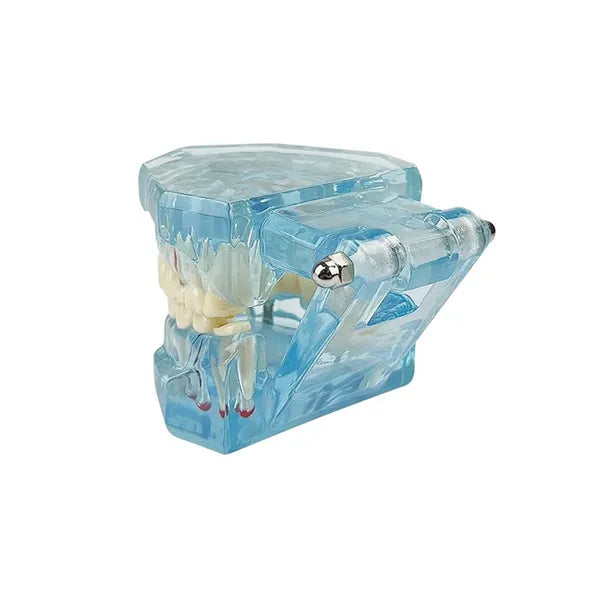 Fogászati állkapocs-modell 14 kivehető foggal, 10×7,5×6,5 cm