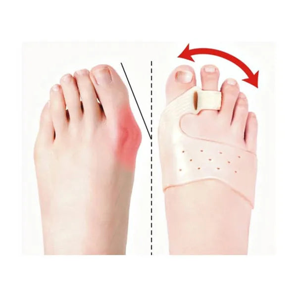 Hallux valgus szilikon lábujj elválasztó mágnessel, 2 db, univerzális